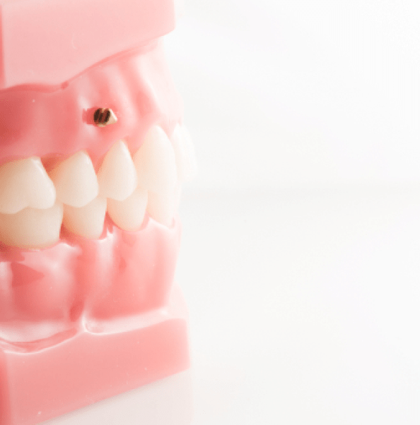 Mini vis Dr Roy Saint-Genis-Pouilly